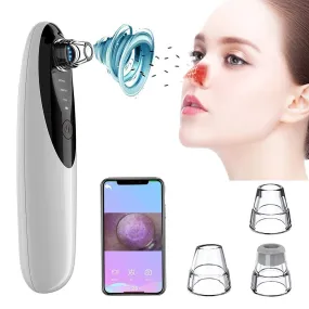 Blackhead Remover Vacuum With Camera Wifi Visible